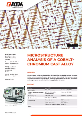 Microstructure analysis of a cobalt chromium cast alloy